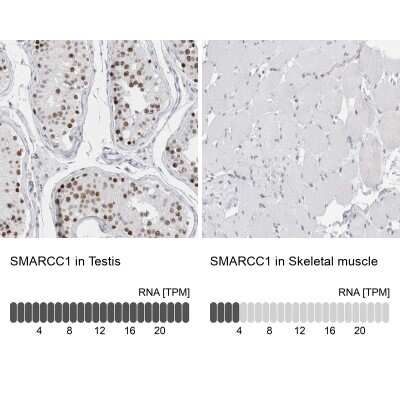 <b>Orthogonal Strategies Validation. </b>Immunohistochemistry-Paraffin: SMARCC1 Antibody [NBP1-88720] - Analysis in human testis and skeletal muscle tissues. Corresponding SMARCC1 RNA-seq data are presented for the same tissues.