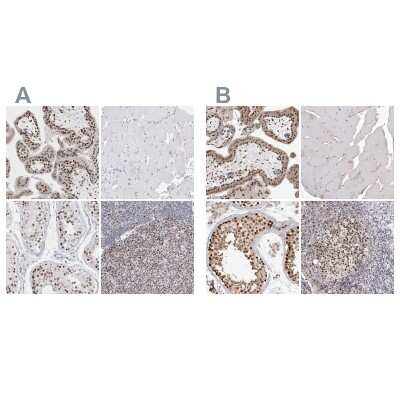 <b>Independent Antibodies Validation. </b>Immunohistochemistry-Paraffin: SMARCC1 Antibody [NBP1-88720] - Staining of human placenta, skeletal muscle, testis and tonsil using Anti-SMARCC1 antibody NBP1-88720 (A) shows similar protein distribution across tissues to independent antibody NBP1-88721 (B).