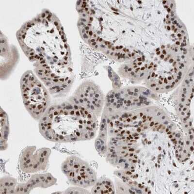 Immunohistochemistry-Paraffin: SMARCC1 Antibody [NBP1-88720] - Staining of human placenta shows strong nuclear positivity in trophoblastic cells.