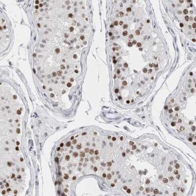 Immunohistochemistry-Paraffin: SMARCC1 Antibody [NBP1-88720] - Staining of human testis shows strong nuclear positivity in cells in seminiferous ducts.