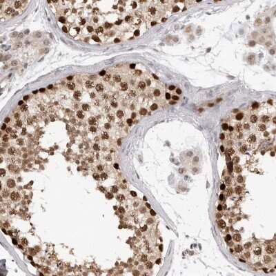 Immunohistochemistry-Paraffin: SMARCC1 Antibody [NBP1-88721] - Staining of human testis shows high expression.