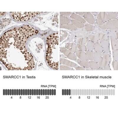 <b>Orthogonal Strategies Validation. </b>Immunohistochemistry-Paraffin: SMARCC1 Antibody [NBP1-88721] - Staining in human testis and skeletal muscle tissues using anti-SMARCC1 antibody. Corresponding SMARCC1 RNA-seq data are presented for the same tissues.