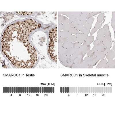 <b>Orthogonal Strategies Validation. </b>Immunohistochemistry-Paraffin: SMARCC1 Antibody [NBP1-88721] - Analysis in human testis and skeletal muscle tissues. Corresponding SMARCC1 RNA-seq data are presented for the same tissues.