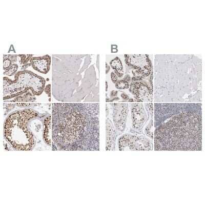 <b>Independent Antibodies Validation. </b>Immunohistochemistry-Paraffin: SMARCC1 Antibody [NBP1-88721] - Staining of human placenta, skeletal muscle, testis and tonsil using Anti-SMARCC1 antibody NBP1-88721 (A) shows similar protein distribution across tissues to independent antibody NBP1-88720 (B).