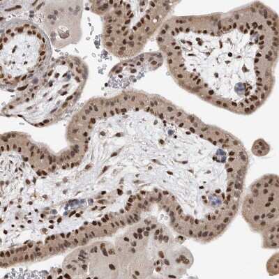 Immunohistochemistry-Paraffin: SMARCC1 Antibody [NBP1-88721] - Staining of human placenta shows strong nuclear positivity in trophoblastic cells.