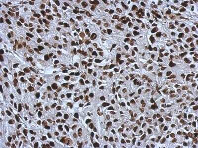 Immunohistochemistry-Paraffin: SMARCC1 Antibody [NBP2-20415] - Immunohistochemical analysis of paraffin-embedded RT2 xenograft, using antibody at 1:500 dilution.