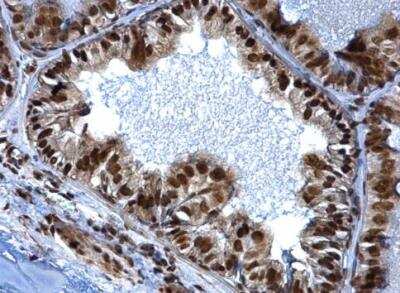 Immunohistochemistry-Paraffin: SMARCC1 Antibody [NBP2-20415] - Paraffin-embedded mouse prostate dilution: 1:500.