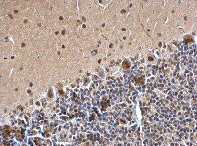 Immunohistochemistry-Paraffin: SMARCC1 Antibody [NBP2-20415] - Paraffin-embedded rat hind brain dilution: 1:500.