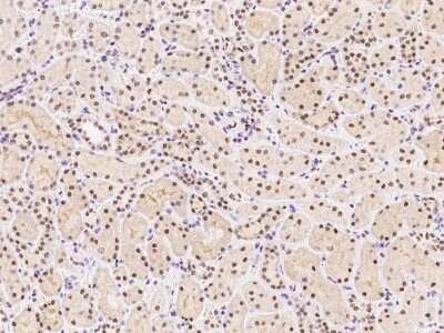 Immunohistochemistry-Paraffin: SMARCC1 Antibody [NBP2-98777] - Immunochemical staining of human SMARCC1 in human kidney with rabbit polyclonal antibody at 1:1000 dilution, formalin-fixed paraffin embedded sections.