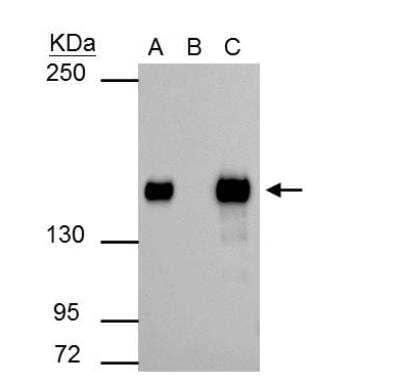 Immunoprecipitation: SMARCC1 Antibody [NBP2-20415] - SMARCC1 antibody immunoprecipitates SMARCC1 protein in IP experiments. IP Sample: 293T whole cell lysate/extract A : 30 ug whole cell lysate/extract of SMARCC1 protein expressing 293T cells B : Control with 2.5 ug of pre-immune rabbit IgG C : Immunoprecipitation of SMARCC1 by 2.5 ug of SMARCC1 antibody  5% SDS-PAGE The  mmunoprecipitated SMARCC1 protein was detected by SMARCC1 antibody  diluted at 1:1000. EasyBlot anti-rabbit IgG (HRP)  was used as a secondary reagent.