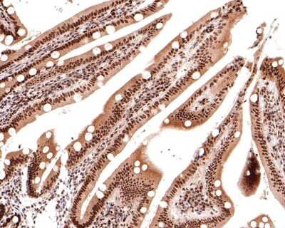 Immunohistochemistry-Paraffin: SMARCC1 Antibody (JB43-43) [NBP2-75666] - Analysis of paraffin-embedded human small intestine tissue using anti-SMARCC1 antibody. The section was pre-treated using heat mediated antigen retrieval with sodium citrate buffer (pH 6.0) for 20 minutes. The tissues were blocked in 1% BSA for 30 minutes at room temperature, washed with ddH2O and PBS, and then probed with the primary antibody (1/400) for 30 minutes at room temperature. The detection was performed using an HRP conjugated compact polymer system. DAB was used as the chromogen. Tissues were counterstained with hematoxylin and mounted with DPX.