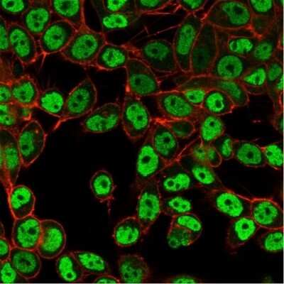 Immunocytochemistry/Immunofluorescence: SMARCC1 Antibody (PCRP-SMARCC1-1F1) [NBP3-07623] - Immunofluorescent Analysis of PFA-fixed HeLa cells. SMARCC1 Mouse Monoclonal Antibody (PCRP-SMARCC1-1F1) followed by IgG-CF488 (green), counterstained with phalloidin.