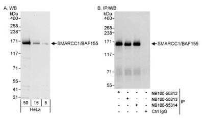 Western Blot: SMARCC1 Antibody [NB100-55312] - Detection of Human SMARCC1/BAF155 on HeLa whole cell lysate using NB100-55312. SMARCC1/BAF155 was also IPed by rabbit anti-SMARCC1/BAF155 antibodies NB100-55313 and NB100-55314.