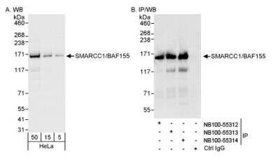 Western Blot: SMARCC1 Antibody [NB100-55314] - Detection of Human SMARCC1/BAF155 on HeLa whole cell lysate using NB100-55314. SMARCC1/BAF155 was also IPed by rabbit anti-SMARCC1/BAF155 antibodies NB100-55312 and NB100-55313.