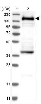 Western Blot: SMARCC1 Antibody [NBP1-88720] - Lane 1: Marker  [kDa] 230, 130, 95, 72, 56, 36, 28, 17, 11.  Lane 2: Human cell line RT-543