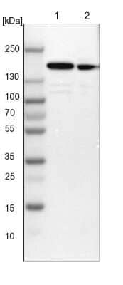 Western Blot: SMARCC1 Antibody [NBP1-88720] - Lane 1: NIH-3T3 cell lysate (Mouse embryonic fibroblast cells) Lane 2: NBT-II cell lysate (Rat Wistar bladder tumour cells)