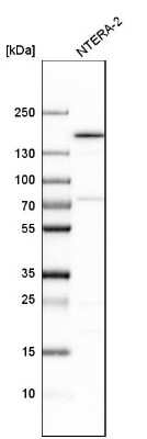 Western Blot: SMARCC1 Antibody [NBP1-88721] - Analysis in human cell line NTERA-2.