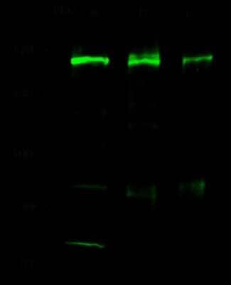 Western Blot: SMARCC1 Antibody [NBP2-98776] - Anti-SMARCC1 rabbit polyclonal antibody at 1:500 dilution. Lane A: Jurkat Whole Cell Lysate. Lane B: Hela Whole Cell Lysate. Lane C: 293T Whole Cell Lysate. Lysates/proteins at 30 ug per lane. Secondary Goat Anti-Rabbit IgG H&L (Dylight 800) at 1/10000 dilution. Developed using the Odyssey technique. Performed under reducing conditions. Predicted band size: 123 kDa. Observed band size: 160 kDa (We are unsure as to the identity of these extra bands).