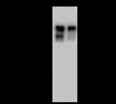 Western Blot: SMARCC1 Antibody [NBP2-98777] - Anti-SMARCC1 rabbit polyclonal antibody at 1:500 dilution. Lane A: HeLa Whole Cell Lysate Lane B: U-87MG Whole Cell Lysate Lysates/proteins at 30 ug per lane. Secondary Goat Anti-Rabbit IgG (H+L)/HRP at 1/10000 dilution. Developed using the ECL technique. Performed under reducing conditions. Predicted band size: 123 kDa. Observed band size: 150 kDa