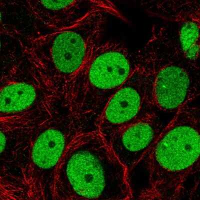 Immunocytochemistry/Immunofluorescence: SMARCC2/BAF170 Antibody [NBP2-57277] - Staining of human cell line MCF7 shows localization to nucleoplasm.