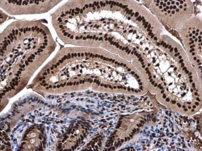 Immunohistochemistry-Paraffin: SMARCC2/BAF170 Antibody [NBP3-12872] - SMARCC2 antibody detects SMARCC2 protein at nucleolus in mouse duodenum by immunohistochemical analysis. Sample: Paraffin-embedded mouse duodenum. SMARCC2 antibody (NBP3-12872) diluted at 1:500. Antigen Retrieval: Citrate buffer, pH 6.0, 15 min