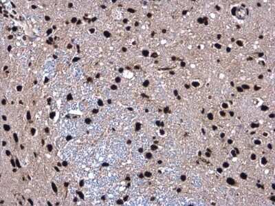 Immunohistochemistry-Paraffin: SMARCC2/BAF170 Antibody [NBP3-12872] - SMARCC2 antibody detects SMARCC2 protein at nucleolus in rat brain by immunohistochemical analysis. Sample: Paraffin-embedded rat brain. SMARCC2 antibody (NBP3-12872) diluted at 1:500. Antigen Retrieval: Citrate buffer, pH 6.0, 15 min