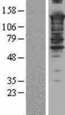 Western Blot SMARCC2/BAF170 Overexpression Lysate