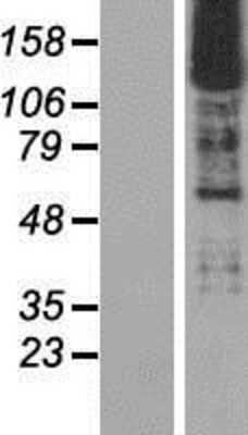 Western Blot SMARCC2/BAF170 Overexpression Lysate