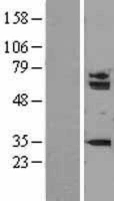 Western Blot: SMARCD1 Overexpression Lysate (Adult Normal) [NBL1-16234] Left-Empty vector transfected control cell lysate (HEK293 cell lysate); Right -Over-expression Lysate for SMARCD1.