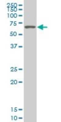 Western Blot: SMARCD2 Antibody (2B2) [H00006603-M02] - SMARCD2 monoclonal antibody (M02), clone 2B2 Analysis of SMARCD2 expression in Hela S3 NE.