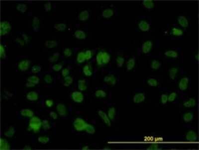 Immunocytochemistry/Immunofluorescence: SMARCD2 Antibody (2F7) [H00006603-M01] - Analysis of monoclonal antibody to SMARCD2 on HeLa cell. Antibody concentration 10 ug/ml.