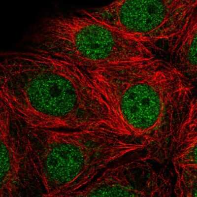 Immunocytochemistry/Immunofluorescence: SMARCD2 Antibody [NBP2-56267] - Staining of human cell line MCF7 shows localization to nucleoplasm.