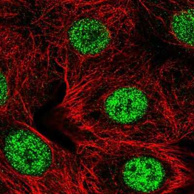 Immunocytochemistry/Immunofluorescence: SMARCD2 Antibody [NBP2-57074] - Staining of human cell line MCF7 shows localization to nucleoplasm.