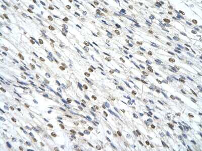 Immunohistochemistry-Paraffin: SMARCD2 Antibody [NBP3-10472] - Immunohistochemical analysis of paraffin-embedded human cardiac cell tissue.