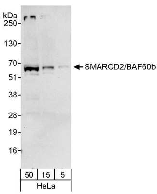 Western Blot: SMARCD2 Antibody [NB100-79838] - Whole cell lysate (5, 15 and 50 ug) from HeLa cells. Antibody used for WB at 0.04 ug/ml.