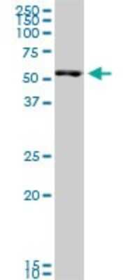 Western Blot SMARCD3 Antibody (5B6) - Azide and BSA Free