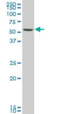 Western Blot: SMARCD3 Antibody (5B6) [H00006604-M04] - Analysis of SMARCD3 expression in NIH/3T3 (Cat # L018V1).