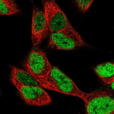 Immunocytochemistry/Immunofluorescence: SMARCD3 Antibody [NBP2-39013] - Immunofluorescent staining of human cell line SH-SY5Y shows localization to nucleoplasm.