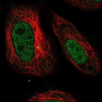 Immunocytochemistry/Immunofluorescence: SMARCD3 Antibody [NBP2-57036] - Staining of human cell line HeLa shows localization to nucleoplasm.