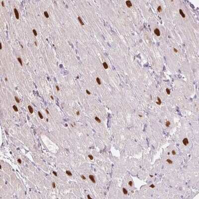 Immunohistochemistry: SMARCD3 Antibody [NBP2-39013] - Staining of human heart muscle shows strong nuclear positivity in myocytes.