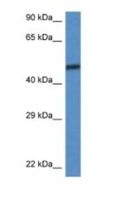 Western Blot: SMARCD3 Antibody [NBP1-79718] - Titration: 1.0 ug/ml Positive Control: Mouse Brain.