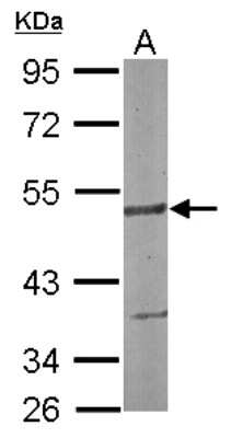 Western Blot: SMARCD3 Antibody [NBP2-15121] - Sample (30 ug of whole cell lysate) A: NIH-3T3 10% SDS PAGE; antibody diluted at 1:1000.