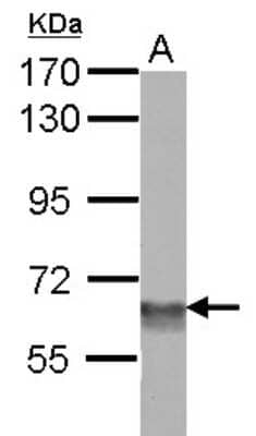 Western Blot: SMARCD3 Antibody [NBP2-15122] - Sample (30 ug of whole cell lysate) A: NIH-3T3 7. 5% SDS PAGE; antibody diluted at 1:5000.