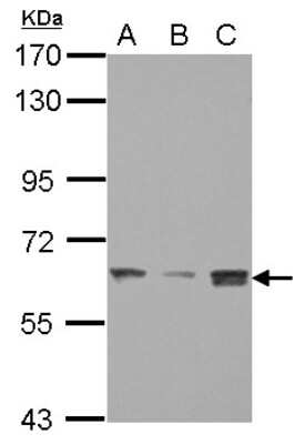 Western Blot: SMARCD3 Antibody [NBP2-15122] - Sample (30 ug of whole cell lysate) A: PC-3 B: U87-MG C: SK-N-SH 7.5% SDS PAGE; antibody diluted at 1:1000.