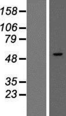 Western Blot: SMARCD3 Overexpression Lysate (Adult Normal) [NBP2-08040] Left-Empty vector transfected control cell lysate (HEK293 cell lysate); Right -Over-expression Lysate for SMARCD3.