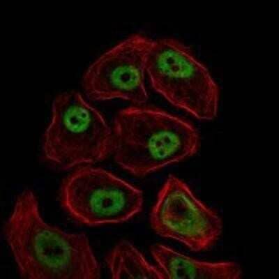 Immunocytochemistry/Immunofluorescence: SMC1 Antibody (5B6) [NBP1-51596] - Analysis of NIH3T3 cells using SMC1 mouse mAb (green). Red: Actin filaments have been labeled with Alexa Fluor-555 phalloidin.