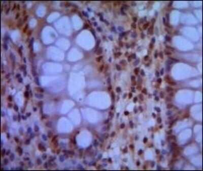 Immunohistochemistry-Paraffin: SMC1 Antibody (5B6) [NBP1-51596] - Analysis of paraffin-embedded human colon using SMC1 mouse mAb with DAB staining.