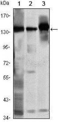 Western Blot: SMC1 Antibody (5B6) [NBP1-51596] - Analysis using SMC1 mouse mAb against K562 (1), Jurkat (2) and A549 (3) cell lysate.