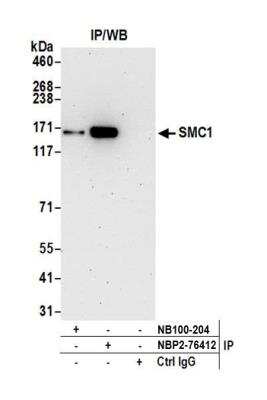 <b>Independent Antibodies Validation. </b>Immunoprecipitation: SMC1 Antibody (BL-205-2G8) [NBP2-76412] - Detection of human SMC1 by WB of immunoprecipitates from HEK293T lysate. Antibodies: Rabbit anti-SMC1 recombinant monoclonal {BL-205-2G8] (NBP2-76412) and rabbit anti-SMC1 (NB100-204).