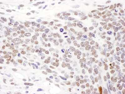 <b>Biological Strategies Validation. </b>Immunohistochemistry: SMC1 Antibody [NBP2-32142] - Sample: FFPE section of mouse teratoma. Antibody: Affinity purified rabbit anti- Phospho SMC1 (S957) used at a dilution of 1:1,000 (1ug/ml). Detection: DAB. Counterstain: Hematoxylin (blue).